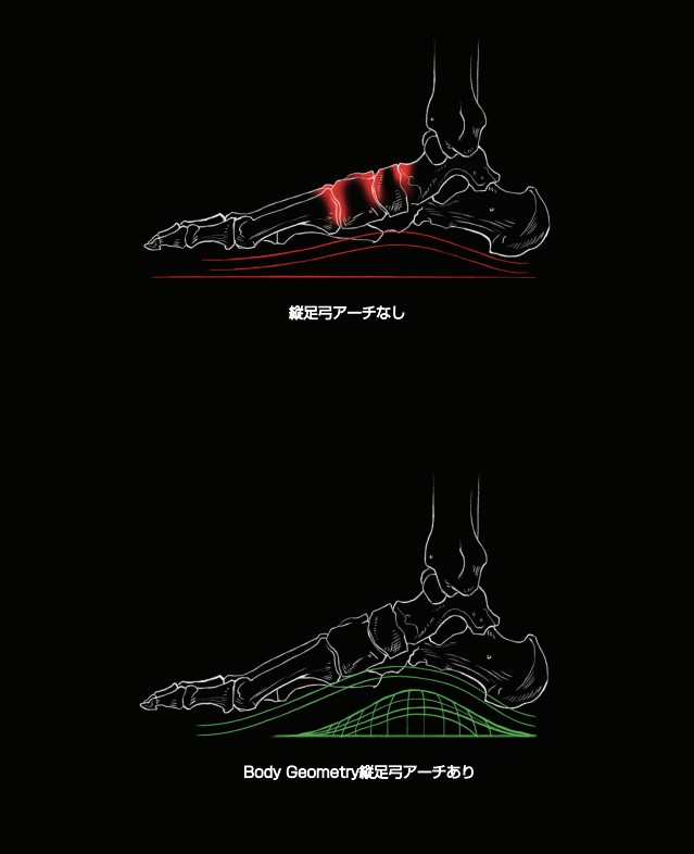 縦足弓のアーチサポート