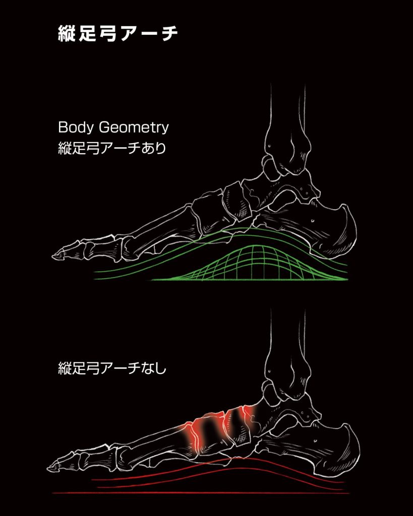 縦足弓のアーチサポート